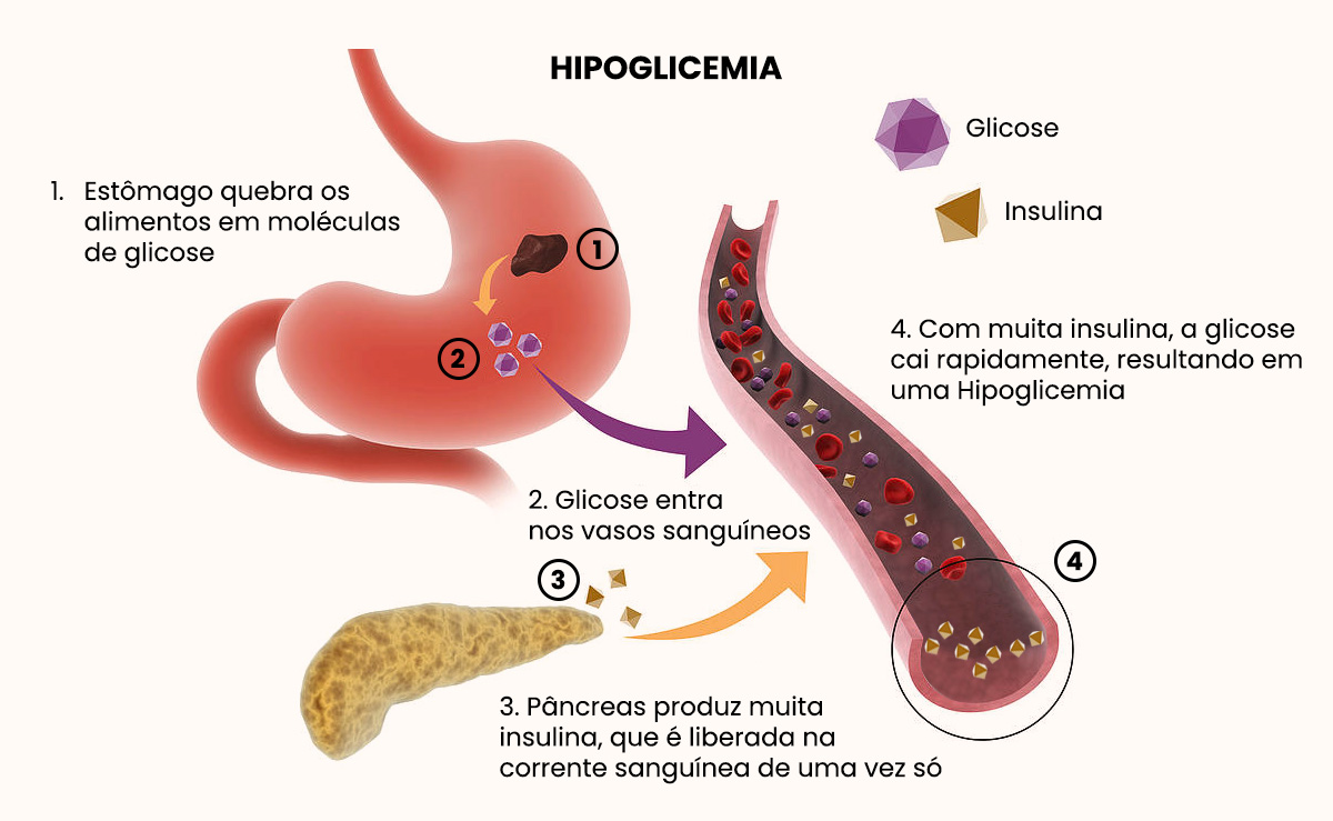 Hipoglicemia pode causar tonturas | Dra. Daniela Janolli