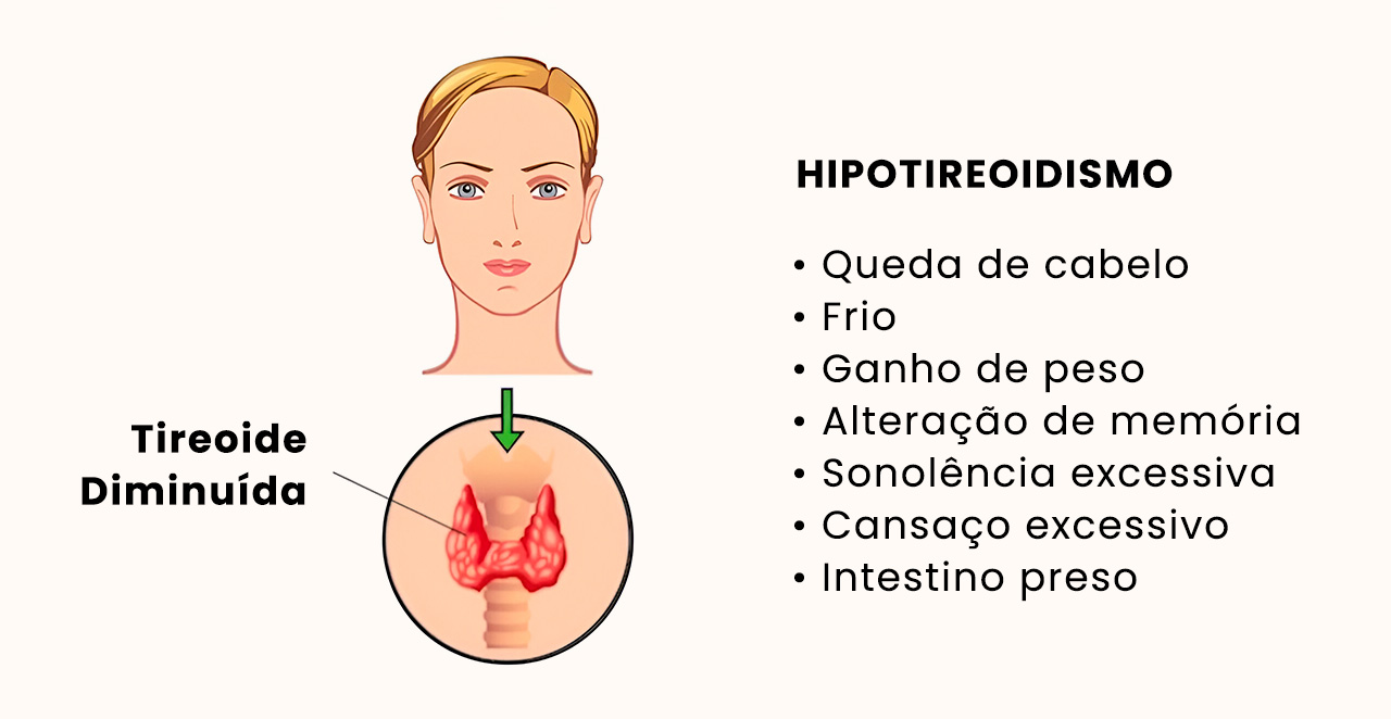 Outros sintomas do hipotireoidismo | Dra. Daniela Janolli