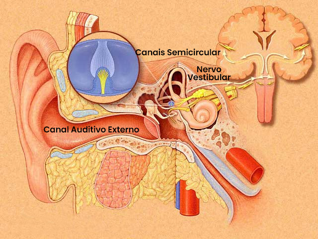 Paroxismia Vestibular | Dra. Daniela Janolli